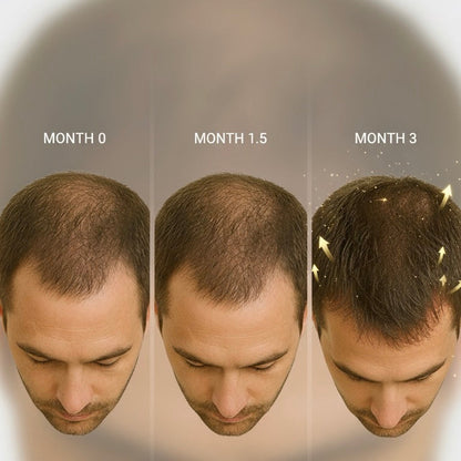 Hair Serum | Advanced Hairfall Control & Regrowth Formula